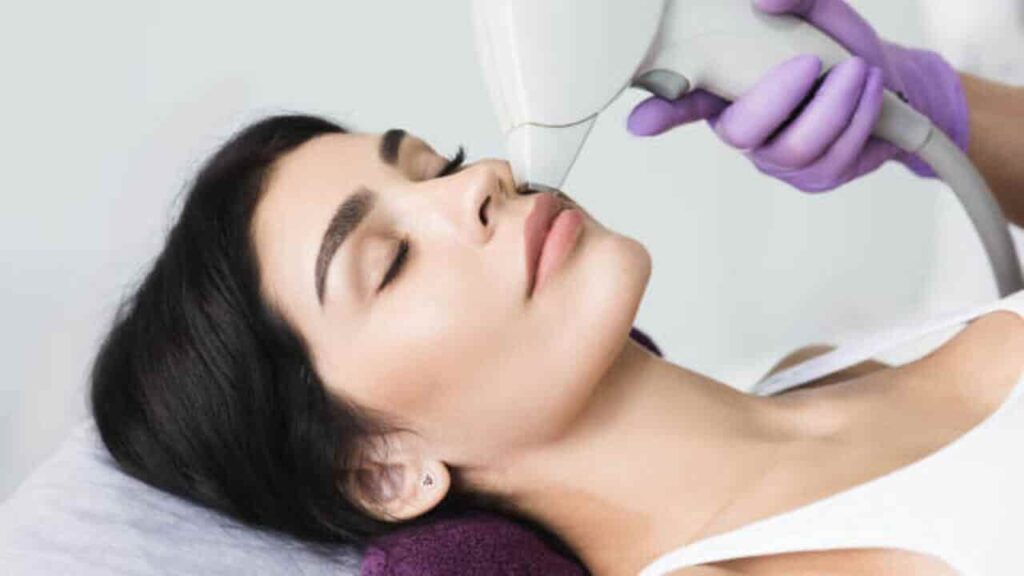 Laser hair Removal | लेज़र हेयर रिमूविंग