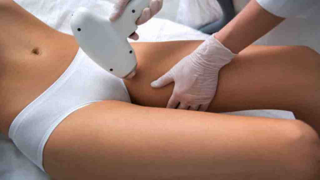 laser-hair-removal-benefit